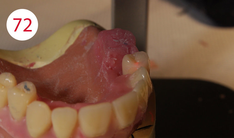 MZBZYU Instant Smile Denti 30 Paia di Superiori e Bretelle Inferiori Impiallacciature Denti Protesi Dentarie Temporanee Estetiche Bretelle Simulate Bretelle 