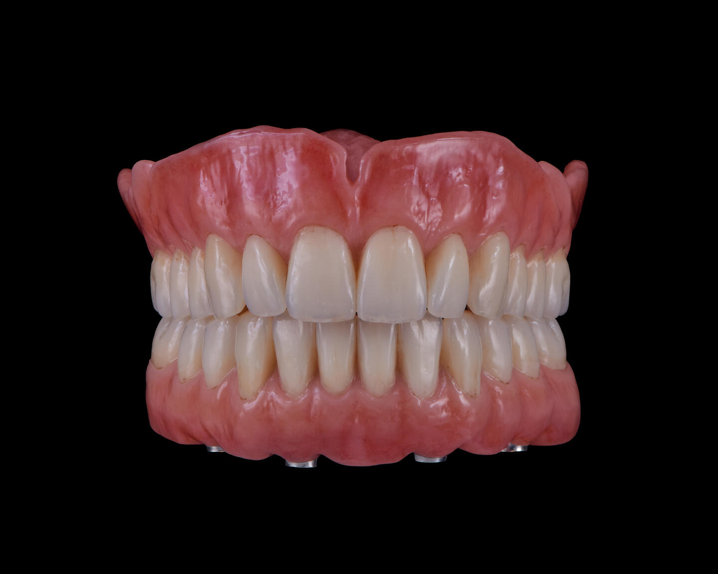 denture