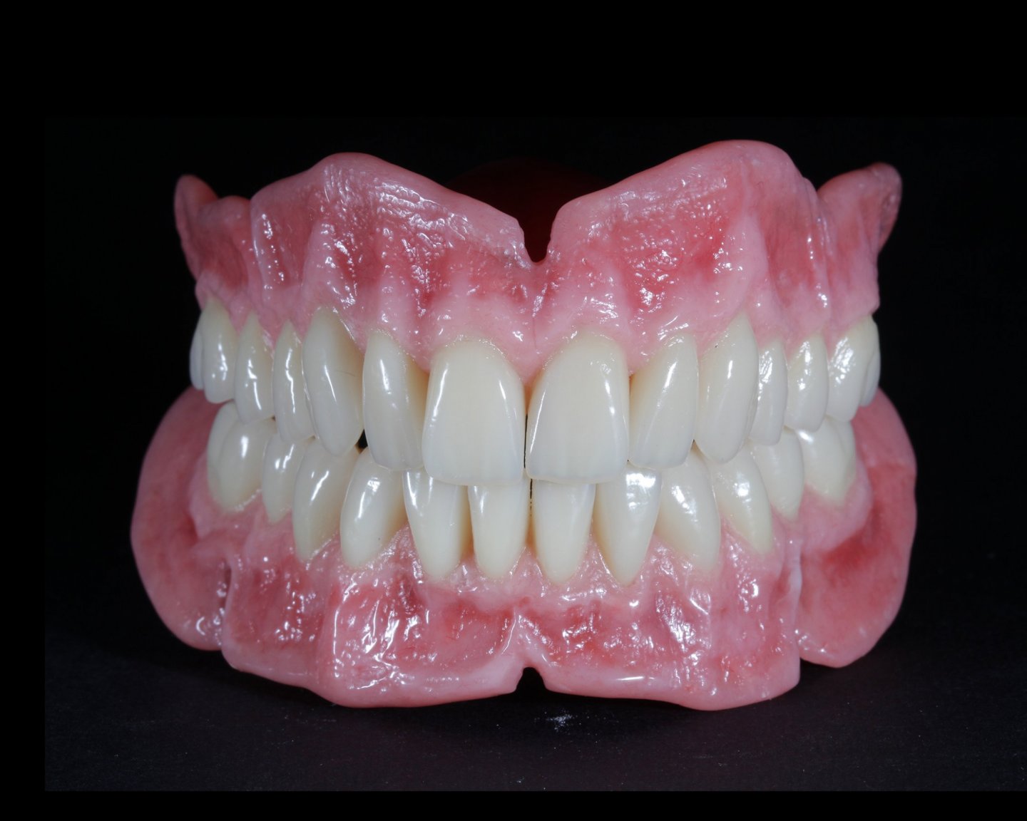 denture